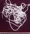 Dirofilaria &ndash; adult;Sursa - http://cal.vet.upenn.edu